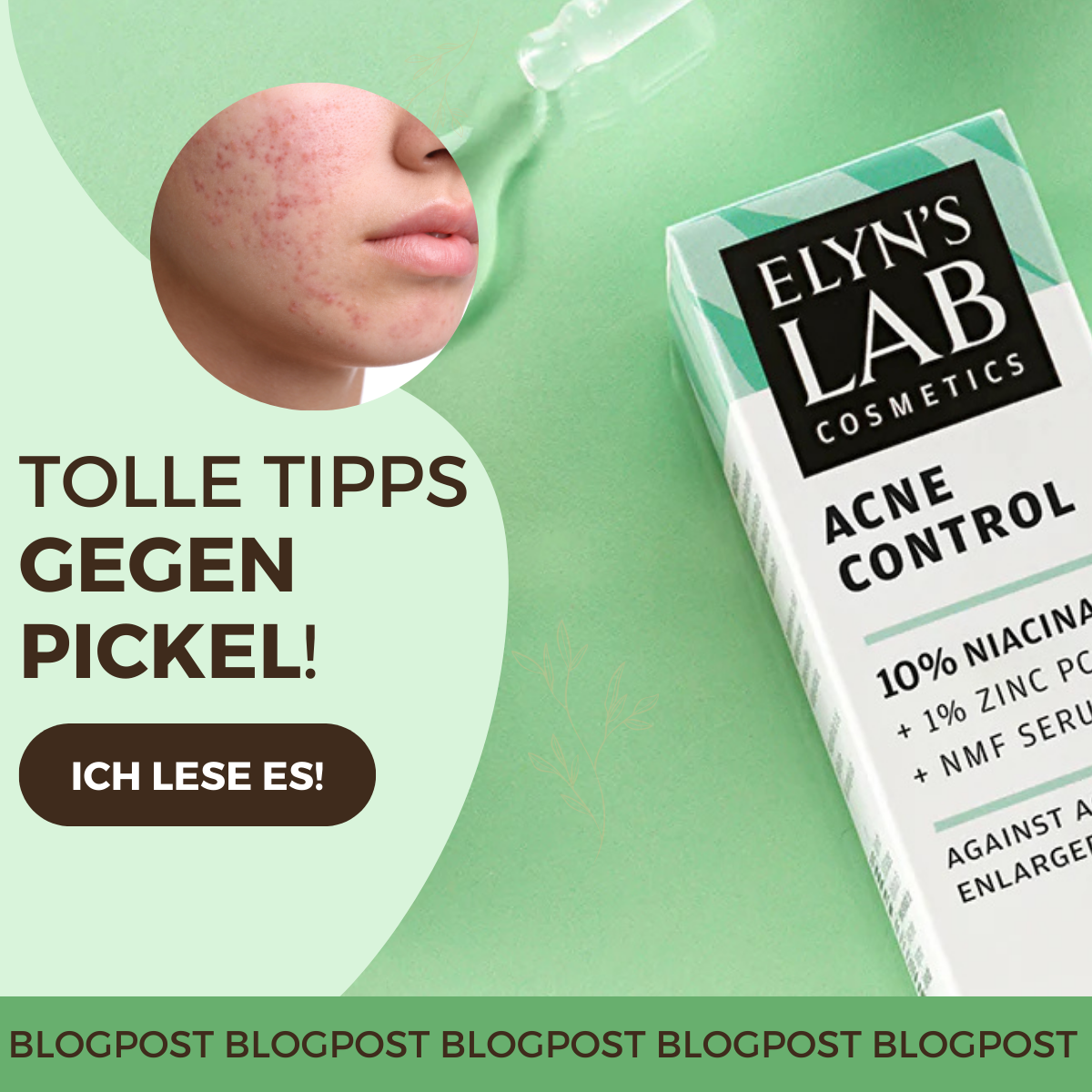 Tolle Tipps gegen Pickel